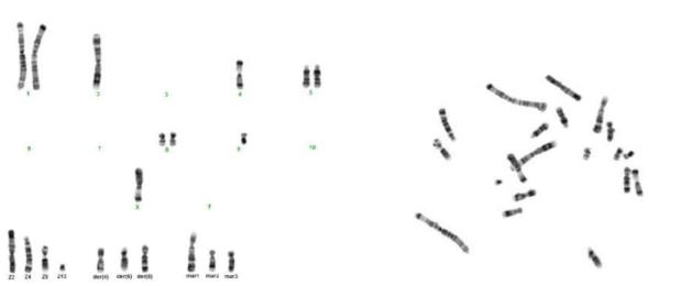 BHK 21 Cell Chromosomal Aberration Analysis