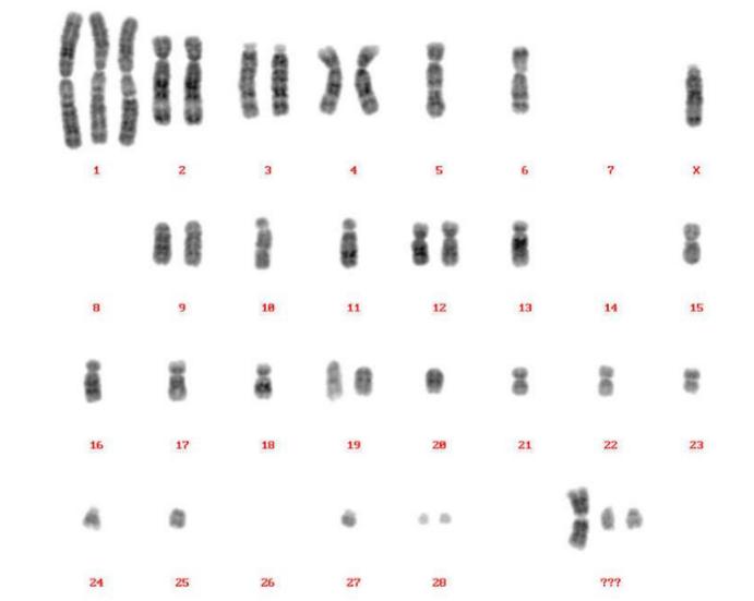 Figure 2. CHO Karyotype generated from CHO cultured cells (:37,X,+1,-5,-6,-7x2,-8x2,-10,-11,-13,-14x2,-15,-16,-17,-18,-20,-21,-22,-23,-24,-25,-26x 2,-27,+3mar)
