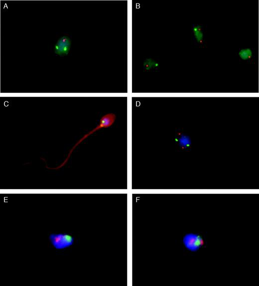 Dual FISH on decondensed sperm nuclei using either locus-specific probes (LSPs) or whole chromosome painting (WCP) probes.