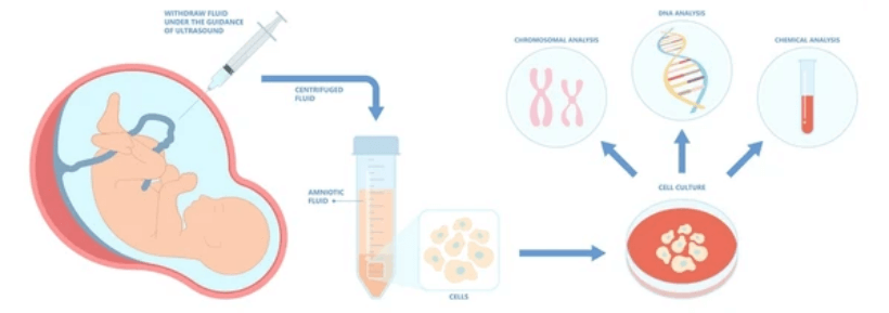 Prenatal and postnatal specimens suited to chromosome preparations. - Creative Bioarray
