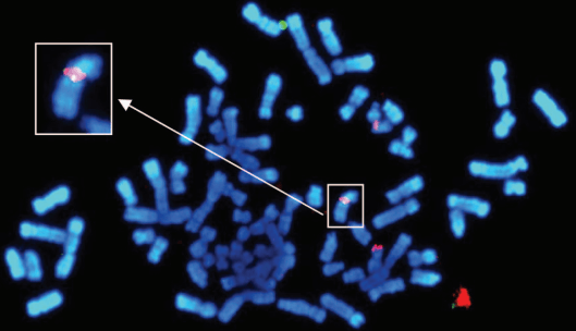 Fluorescence in situ hybridization of metaphase chromosomes from a selected clone.