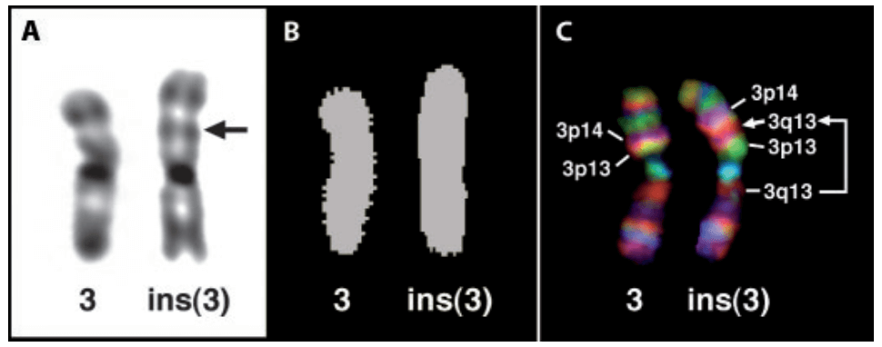 Analysis  of an intrachromosomal aberration.