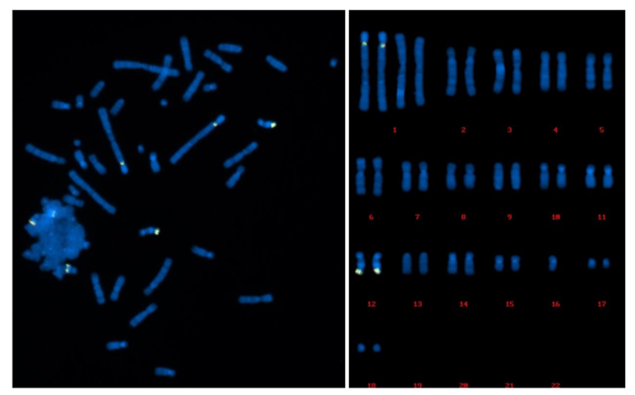 FISH detection of transgene using plasmid probes on CHO metaphase chromosome.