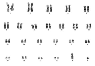 Normal Karyotype generated from human male cultured cells (46, XY)