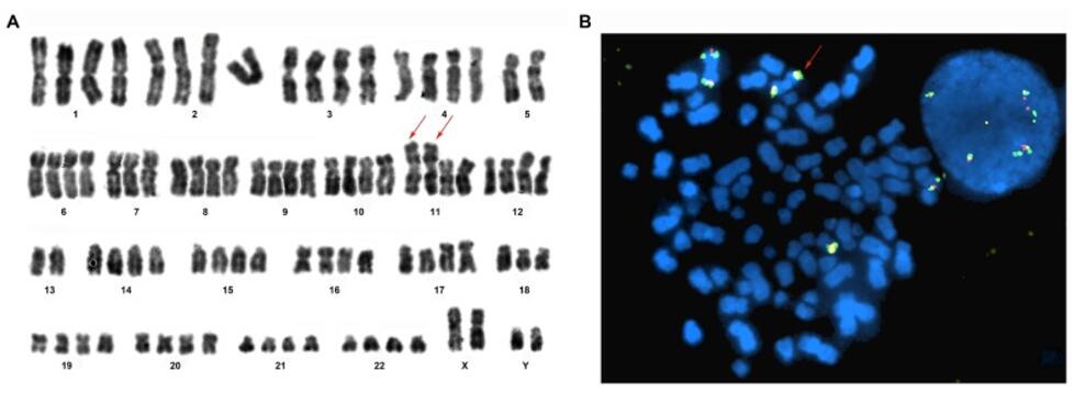 Karyotype and FISH analysis.