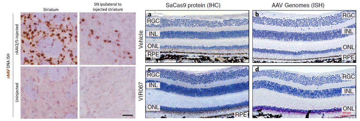 Detection of rAAV viral DNA injected in the rat striatum using the RNAscope technique