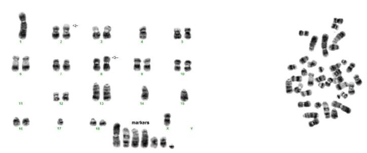 Pig cell line karyotype generated from cultured cells. A representative G-band karyogram of a pig cell showing 37 chromosomes with multiple rearrangements.
