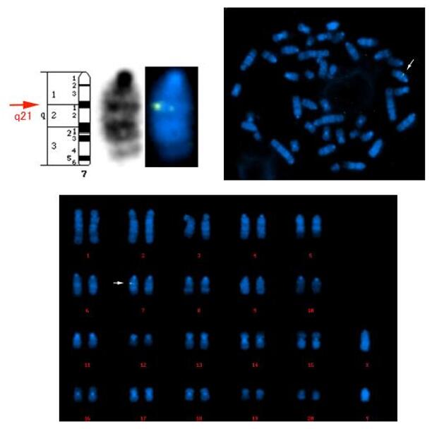 FISH detection of transgene using plasmid probes on rat cell metaphase chromosome.